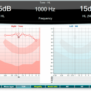 Audiómetro clínico AC40