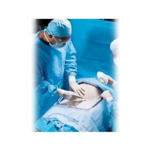 Campo Quirúrgico Hendido Estéril